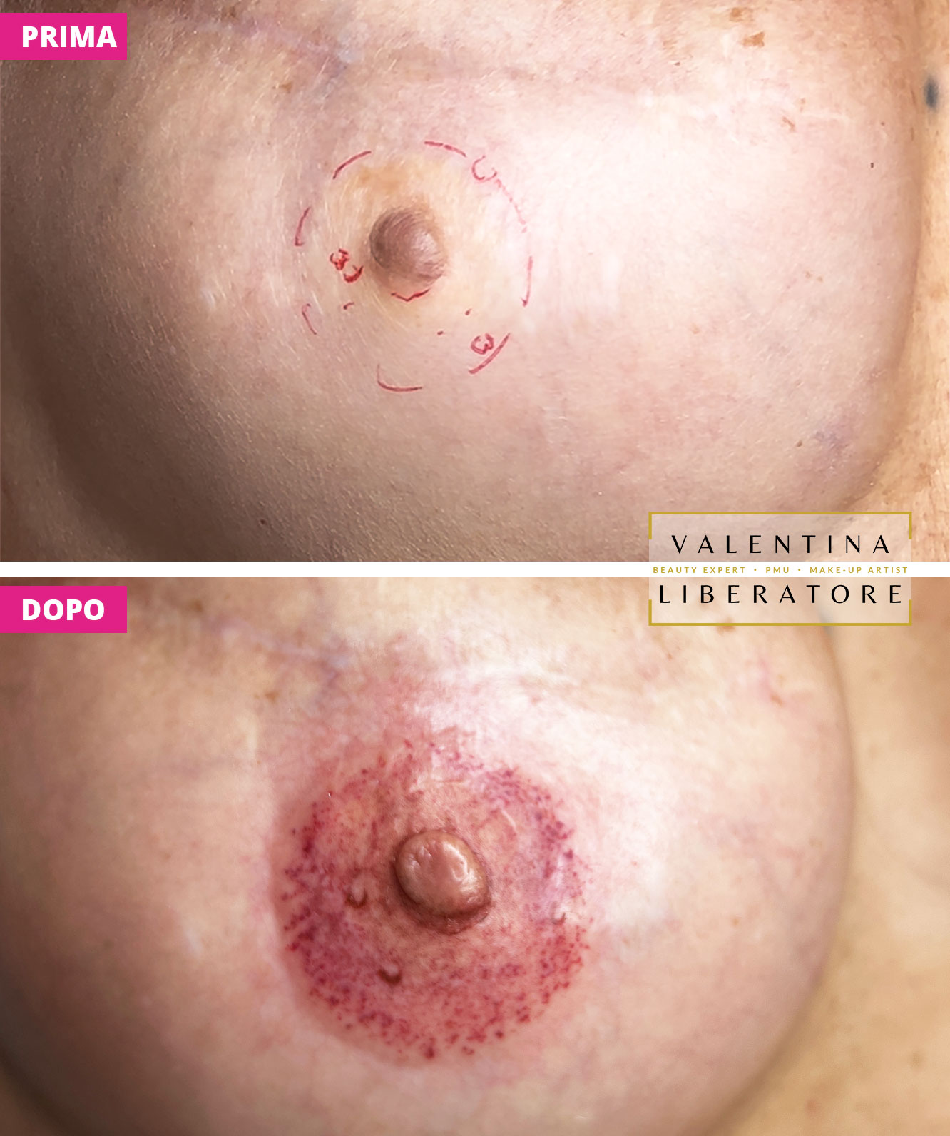 Dermopigmentazione prima/dopo